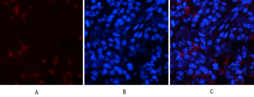 IF - p53 (phospho Thr18) Polyclonal Antibody AP67144